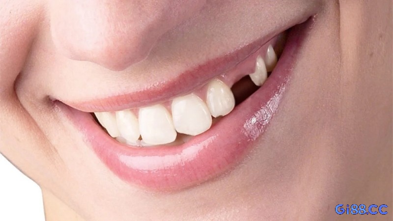 Bị rụng răng trong mộng là điềm báo sẽ tái cấu trúc một điều nào đó