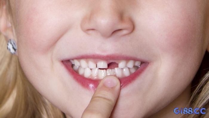 Giải mã giấc mơ bị gãy răng: Ý nghĩa và điềm báo đặc biệt
