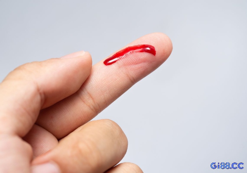 Dựa trên “sổ mơ”, bạn có thể dễ dàng tìm ra gợi ý chiêm bao thấy máu đổ đánh lô số nào phù hợp với từng giấc mơ.