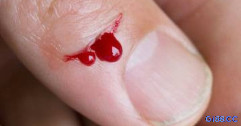 Các giấc mơ về máu bản thân gợi ý rõ ràng về chiêm bao thấy máu đổ đánh lô số nào.